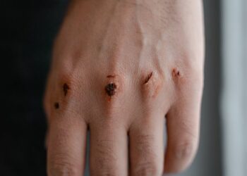 Autolesão e Cobertura de Seguro: Detalhes