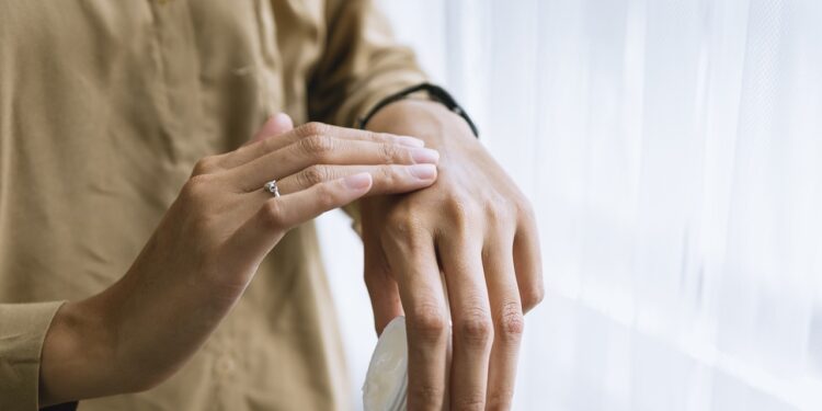 Dermatite atópica tratamento caseiro